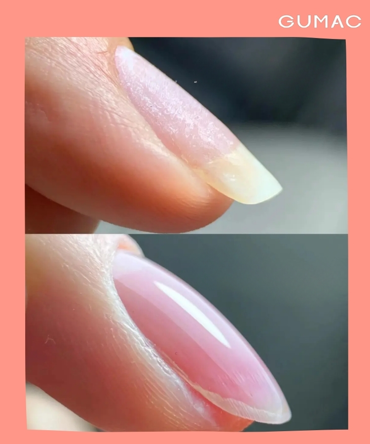 dap gel la gi