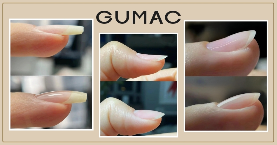 uu diem cua mong dap gel