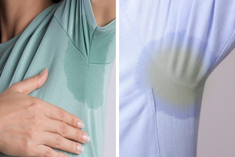 Do mồ hôi của cơ thể gây ố vàng trên áo