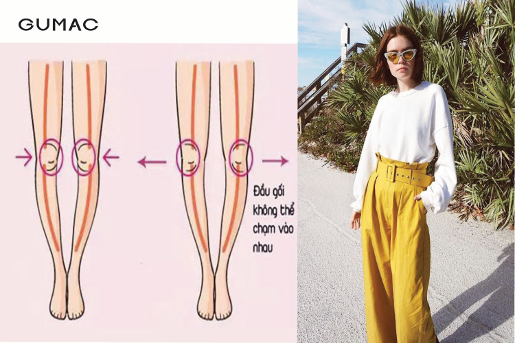 Đôi chân vòng kiềng ảnh hưởng ra sao đến việc chọn item phối đồ
