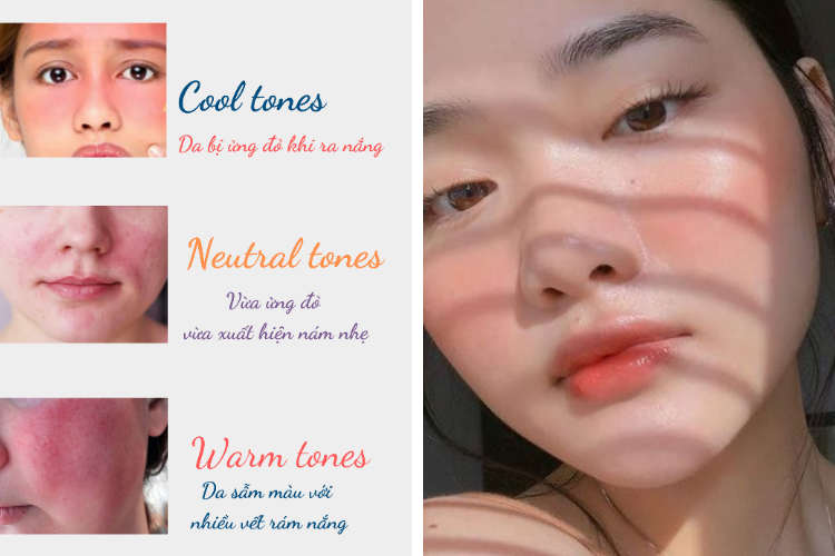 xác định da tone lạnh bằng độ bắt nắng của da
